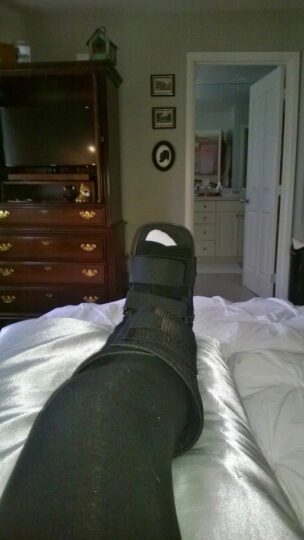 WP_20131025_001 broken foot at home
